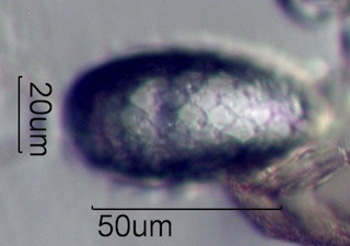 Euglypha