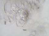 Euglypha
