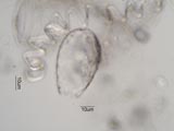 Euglypha