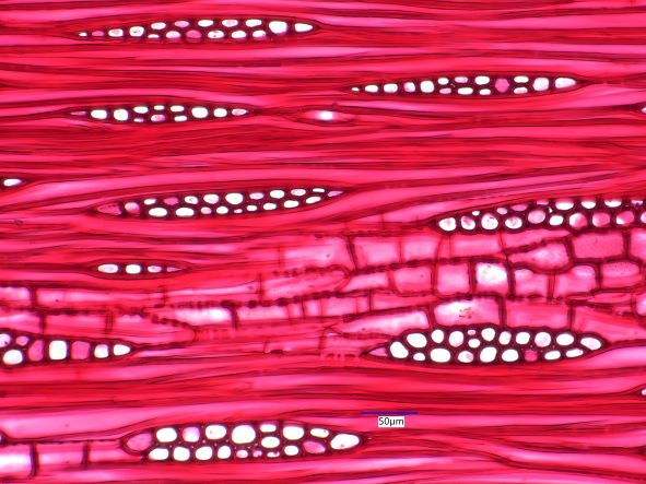 Fraxinus americana, Tangential Section