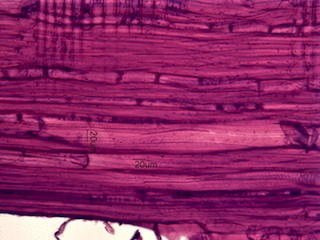 Fagus grandifolia, Radial-Section