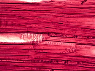 Fagus grandifolia, Radial-Section