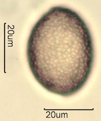 False Solomon’s Seal (Smilacina racemosa) Pollen