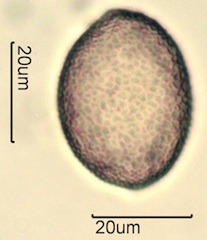 False Solomon’s Seal (Smilacina racemosa) Pollen