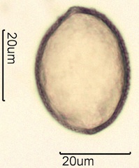 False Solomon’s Seal (Smilacina racemosa) Pollen