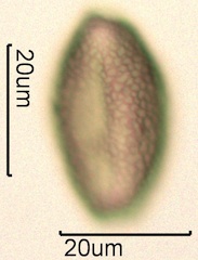 False Solomon’s Seal (Smilacina racemosa) Pollen