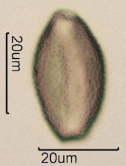 False Solomon’s Seal (Smilacina racemosa) Pollen