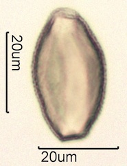 False Solomon’s Seal (Smilacina racemosa) Pollen