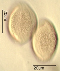 False Solomon’s Seal (Smilacina racemosa) Pollen