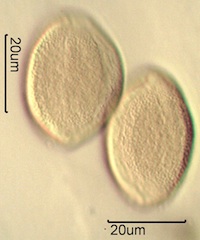 False Solomon’s Seal (Smilacina racemosa) Pollen