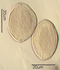 False Solomon’s Seal (Smilacina racemosa) Pollen