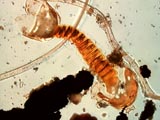 Fern Sporagium