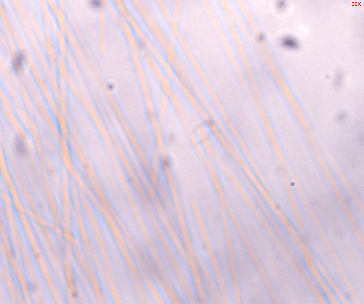 Dispersion Staining