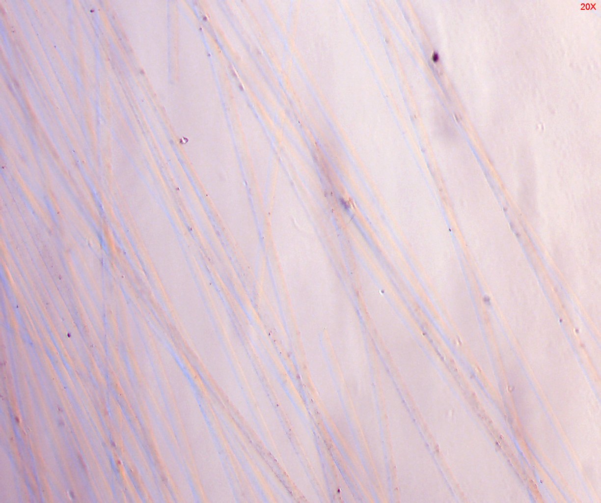 Dispersion Staining