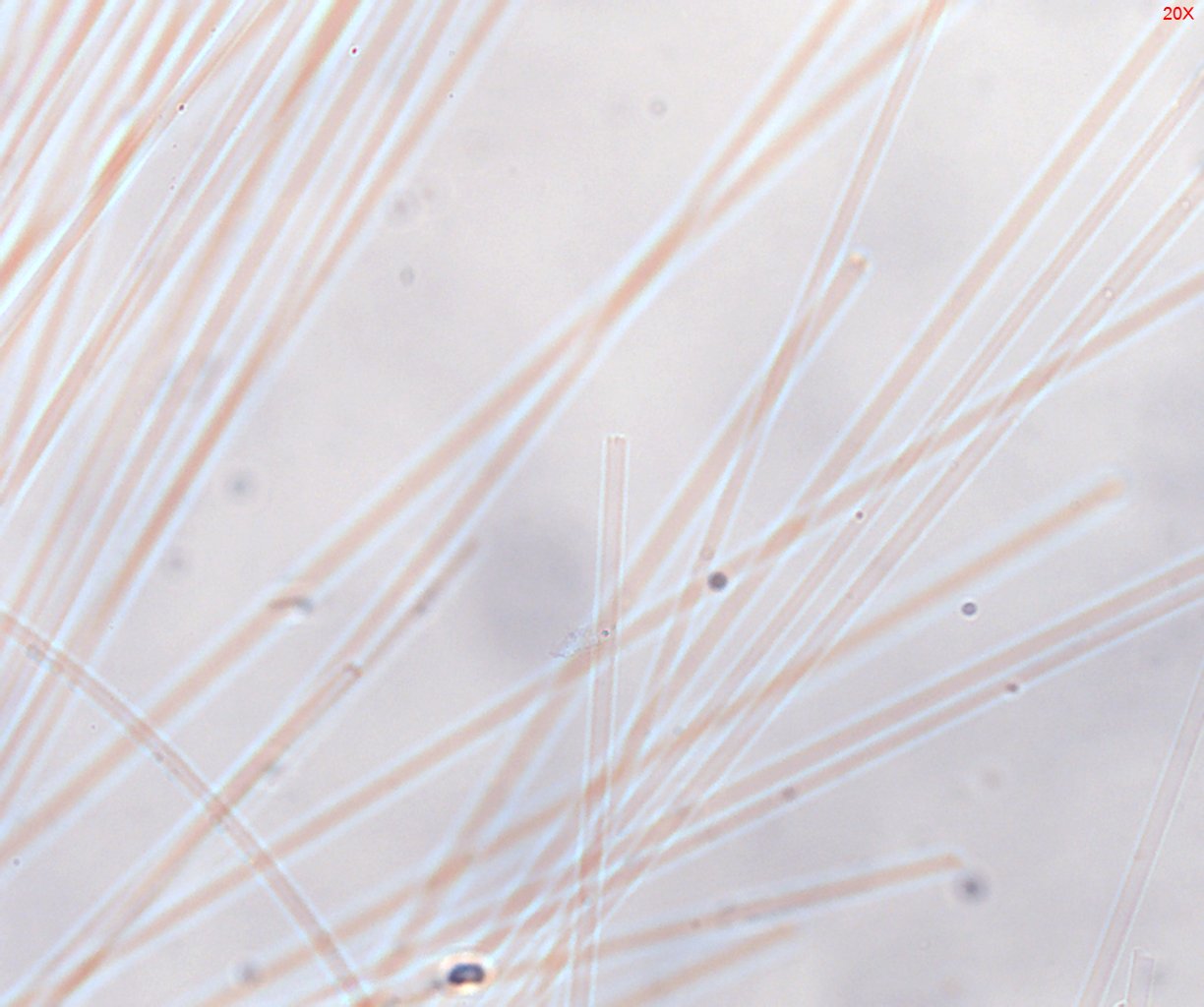 Dispersion Staining