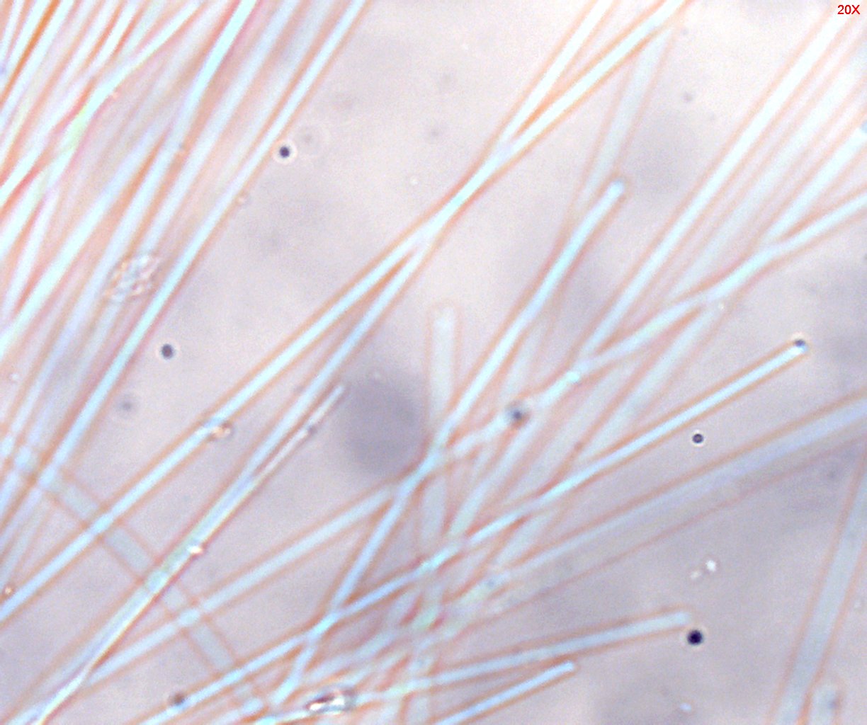 Dispersion Staining