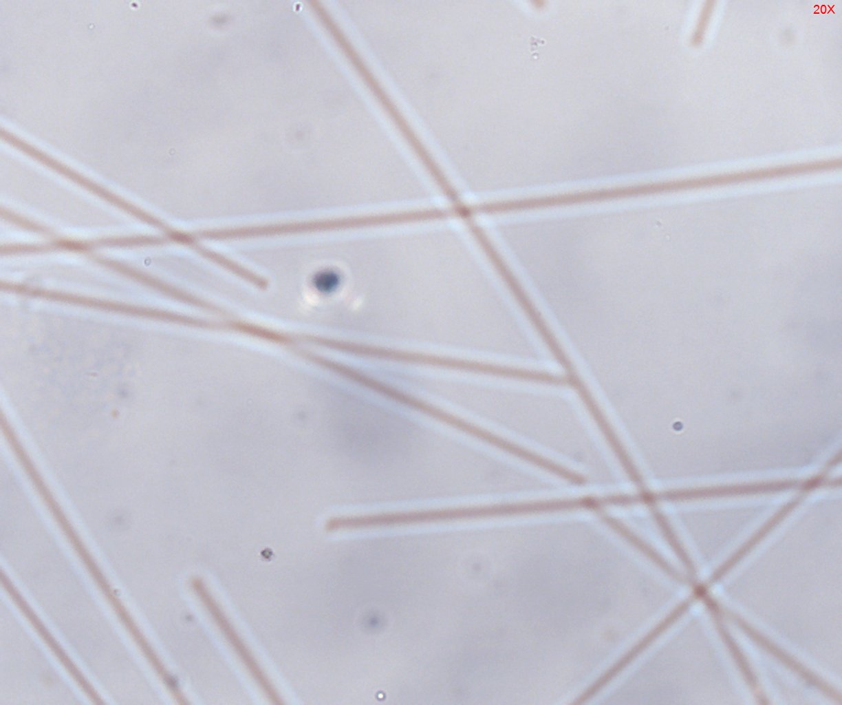Dispersion Staining