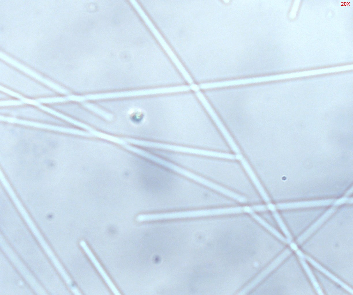 Dispersion Staining