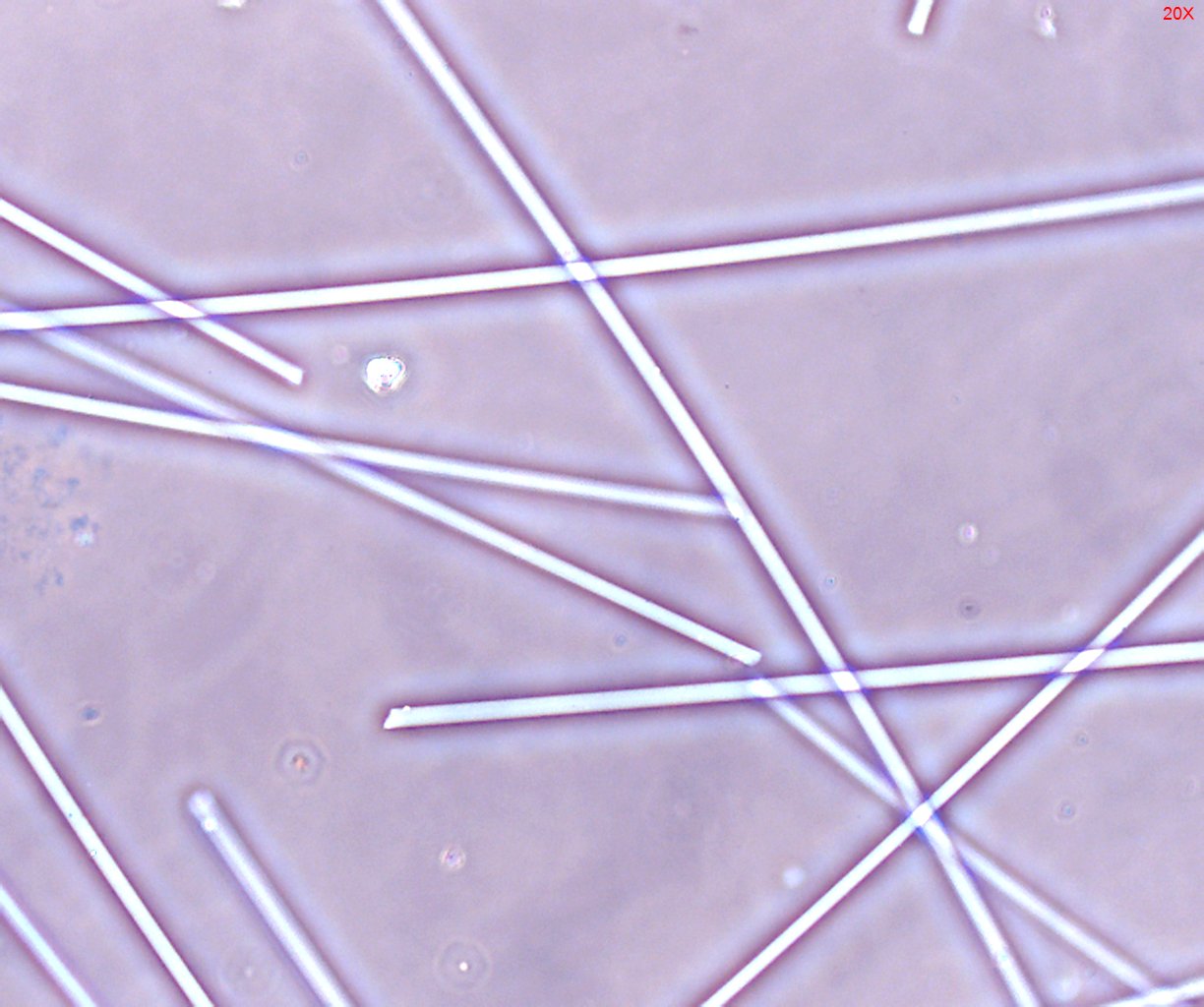 Dispersion Staining