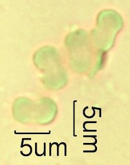 For-Get-Me-Not Pollen under the Microscope