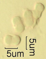 For-Get-Me-Not Pollen under the Microscope
