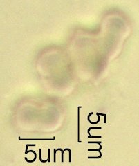 For-Get-Me-Not Pollen under the Microscope