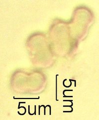 For-Get-Me-Not Pollen under the Microscope