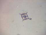 Silicoflagellate