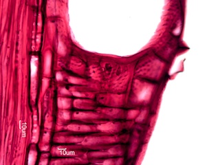 Fraxinus nigra, Radial-Section