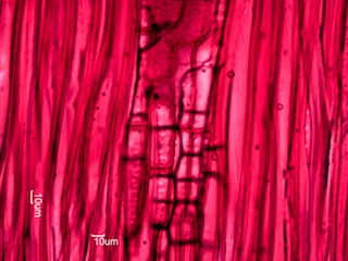 Fraxinus nigra, Radial-Section