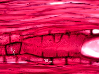 Fraxinus nigra, Radial-Section