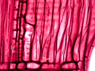 Fraxinus nigra, Radial-Section