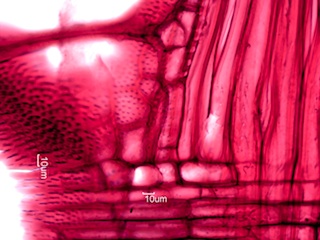 Fraxinus nigra, Radial-Section