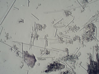 Fiberglass Sawdust from Removing a Medical Cast