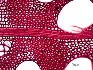 Gleditsia triacanthos, Cross-Section
