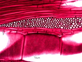 Gleditsia triacanthos, Tangential-Section