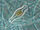 Diatom
