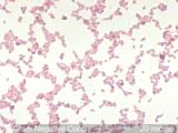 Gram Neg Cocci