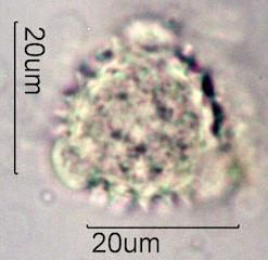 Groundsel Pollen