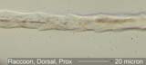 HairRacFl2DorsalProx