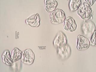 Heather (Calluna vulgaris) Pollen under the Microscope