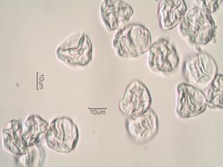 Heather (Calluna vulgaris) Pollen under the Microscope