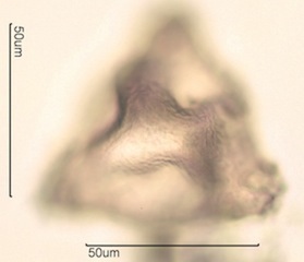 Canadian Honey Pollen Under the Microscope