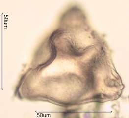 Canadian Honey Pollen Under the Microscope