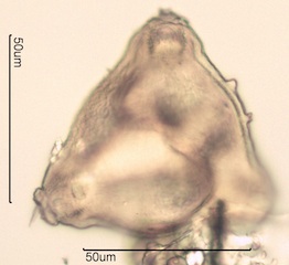 Canadian Honey Pollen Under the Microscope