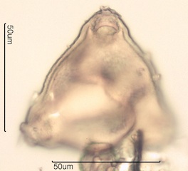 Canadian Honey Pollen Under the Microscope