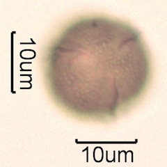 Canadian Honey Pollen Under the Microscope