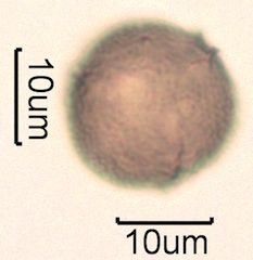 Canadian Honey Pollen Under the Microscope