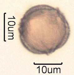 Canadian Honey Pollen Under the Microscope