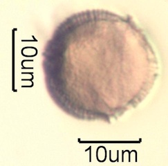 Canadian Honey Pollen Under the Microscope